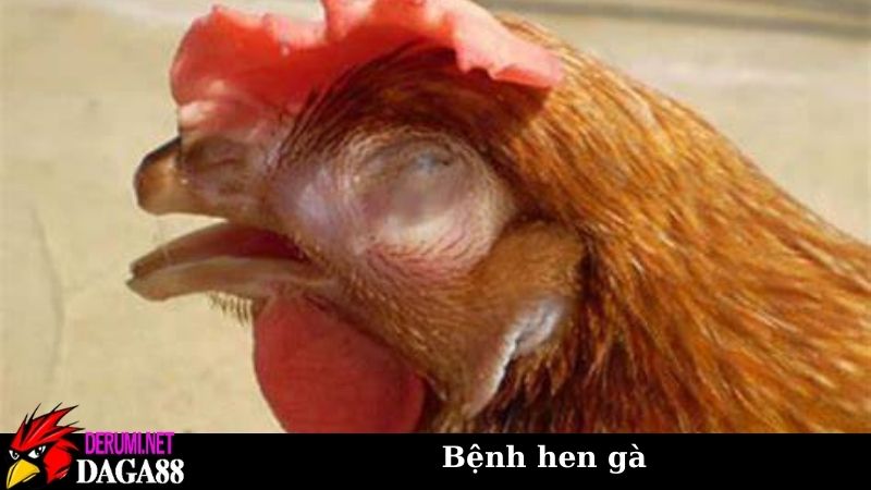 Bệnh hen gà - Dấu hiệu, nguyên nhân, cách phòng và chữa trị 5 Dấu hiệu nhận biết bệnh hen gà ngay từ sớm để can thiệp